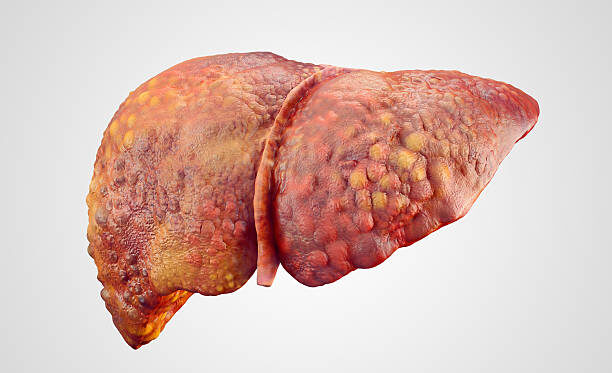 Warning Signs of Liver Damage You Should Never Ignore